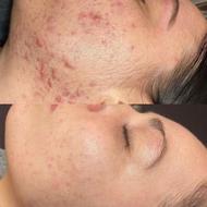 بوتاکس _فیلر_ درمان پوست کره ای_