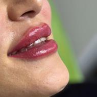 اینجا کمکت میکنیم از دیدن زیبایی هات لذت ببری(لیزر،بوتاکس،ژل