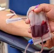 درمان سستی کسالت ،غلظت خون و کبد چرب با فصد خون