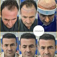 (آفرکاشتمو فقط تا اخر بهمن)یکروزه 18_دوروزه22 میلیون