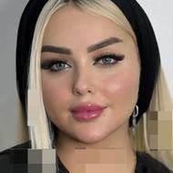 جشنواره زمستانه تزریق ژل و بوتاکس