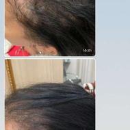 پک مراقبتی مو