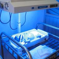 اجاره دستگاه زردی نوزاد و...