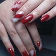 کاشت ترمیم ریمو کاور...