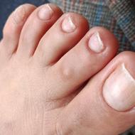 مدل کاشت و ترمیم ناخن برای عکاسی