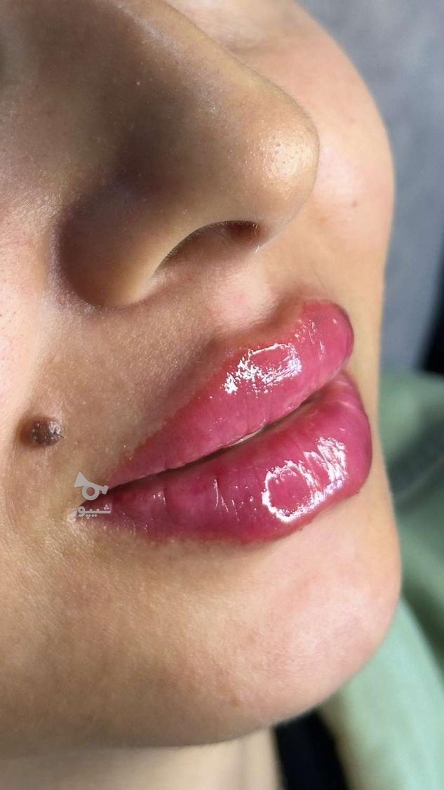 تزریق فیلر/ژل/پیرسینگ/پرسینگ/کاشت مژه