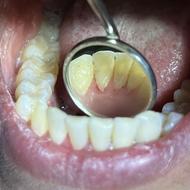 جذب دندانپزشک