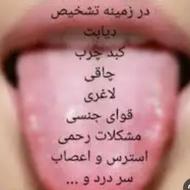 تشخیص بیماری از روی زبان وتلاش برای درمان
