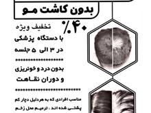 پرپشتی مو بدون کاشت با دستگاه پزشکی در شیپور