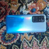 شیائومی نوت 11m