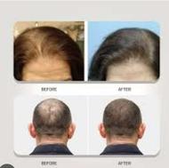 شامپو ضدریزش مو صددرصدگیاهی