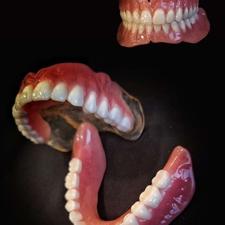 دندان مصنوعی