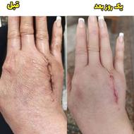 مشاوره رایگان پوست ومو