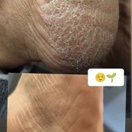 پدیکور و بادکش