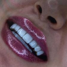 دندانپزشکی زیبایی