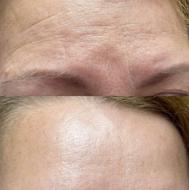 درمان‌ و پاکسازی همه جوره مشکلات پوست صورت