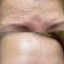 درمان‌ و پاکسازی همه جوره مشکلات پوست صورت