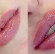 تخفیف عیدانه برای خدمات زیبایی صورت