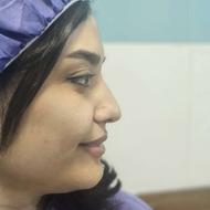 جراحی بینی با کیفیت بالا و هزینه اقتصادی 22 تومن