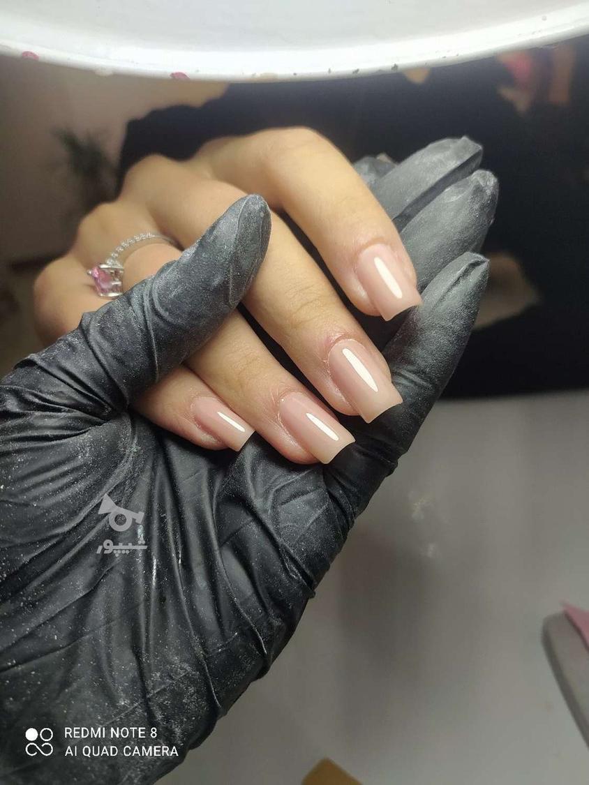 کاشت و ترمیم ناخن