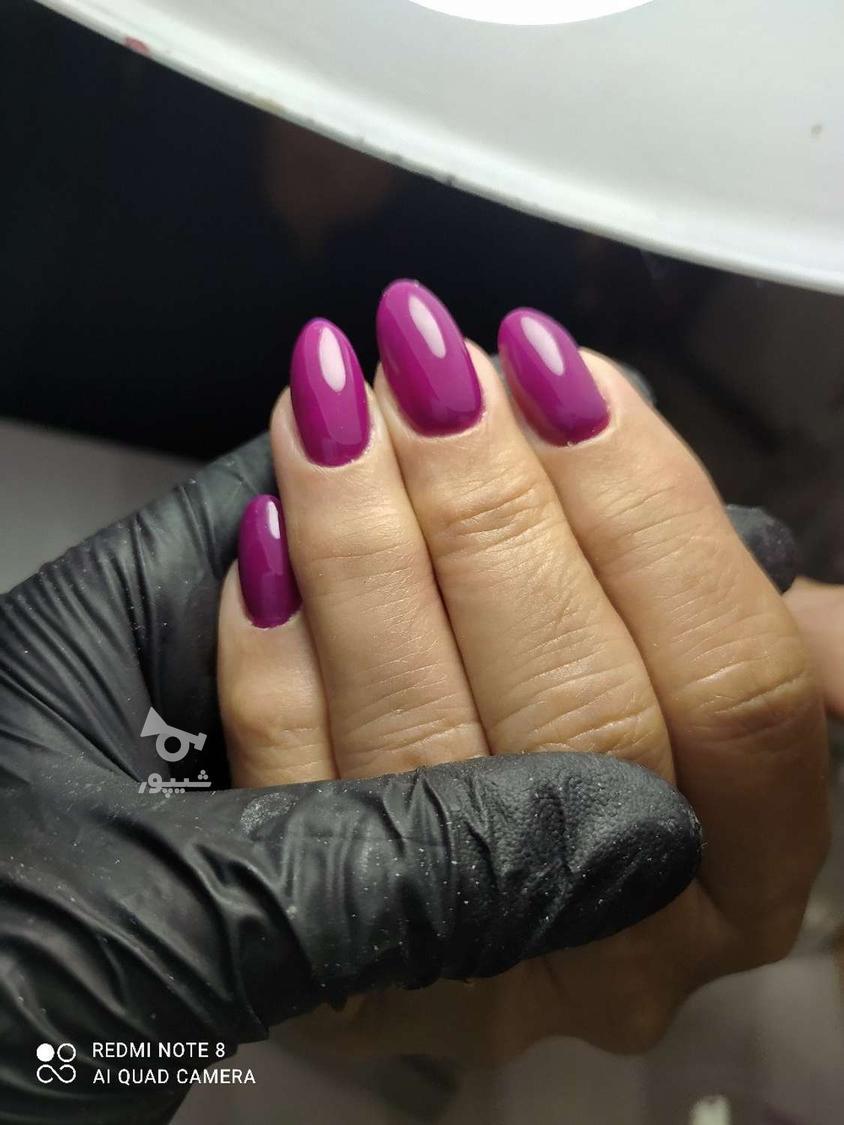 کاشت و ترمیم ناخن