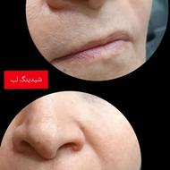 شیدینگ لب و فیبروز ابرو فقط تا آخر بهمن 1تومن