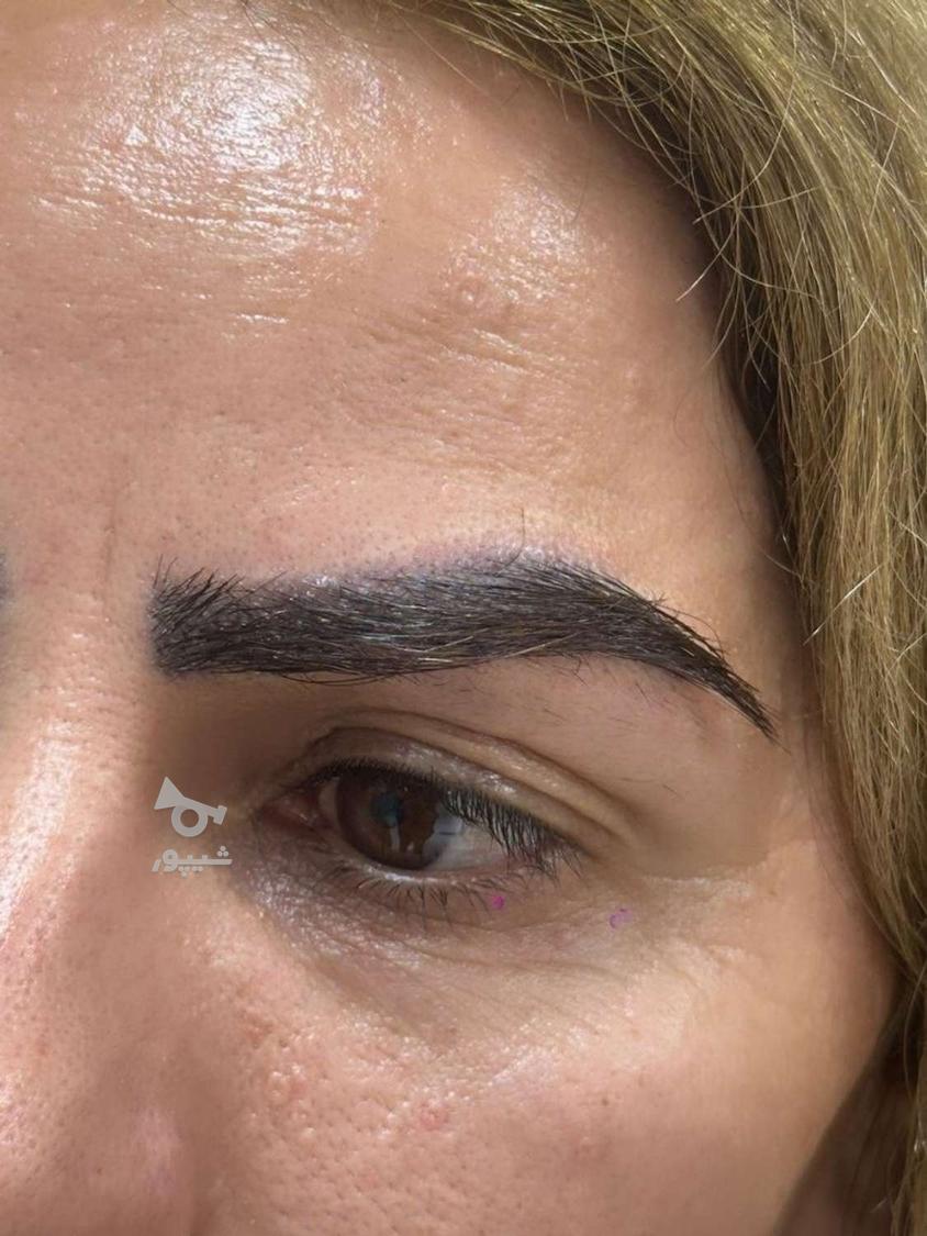 کاشت تخصصی مو با ضمانت