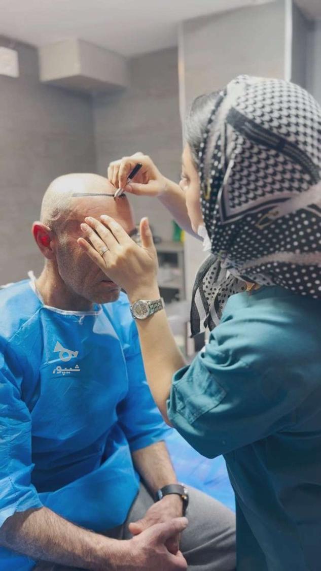 کاشت تخصصی مو با ضمانت