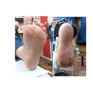 پدیکور و کف سابی فقط و فقط بانوان