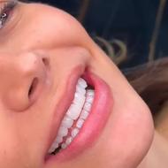 دندانپزشکی مروارید(کامپوزیت،لمینت،عصب کشی،پر کردن و...)