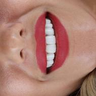 ایمپلنت / 2500+ کاشت موفق/ دندانپزشکی