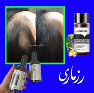 رفع ریزش مو تضمینی