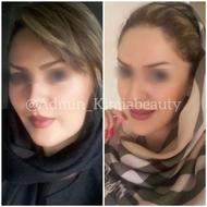 درمان‌ قطعی مشکل مو و پوستی