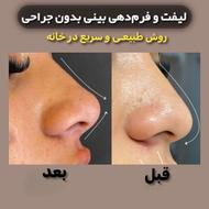 فرم و لیفت گیاهی بینی(این فقط تبلیغ نیست)