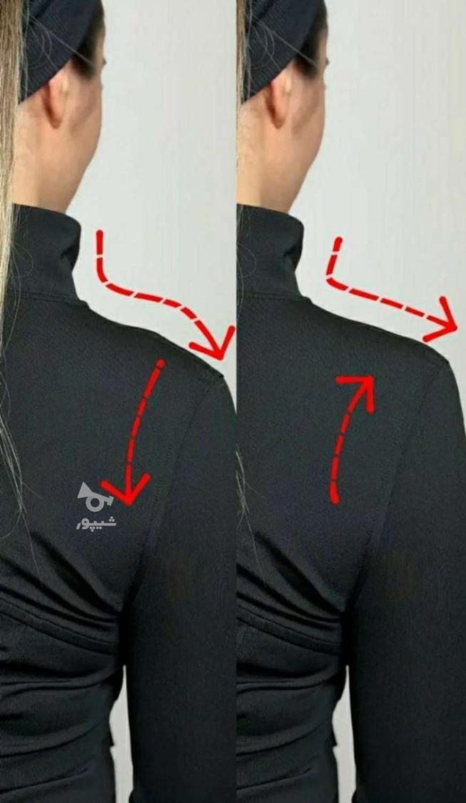 فیلر جوانساز بدن فیلر بادی هیپ دیپ باسن سینه ساق سرشانه و..