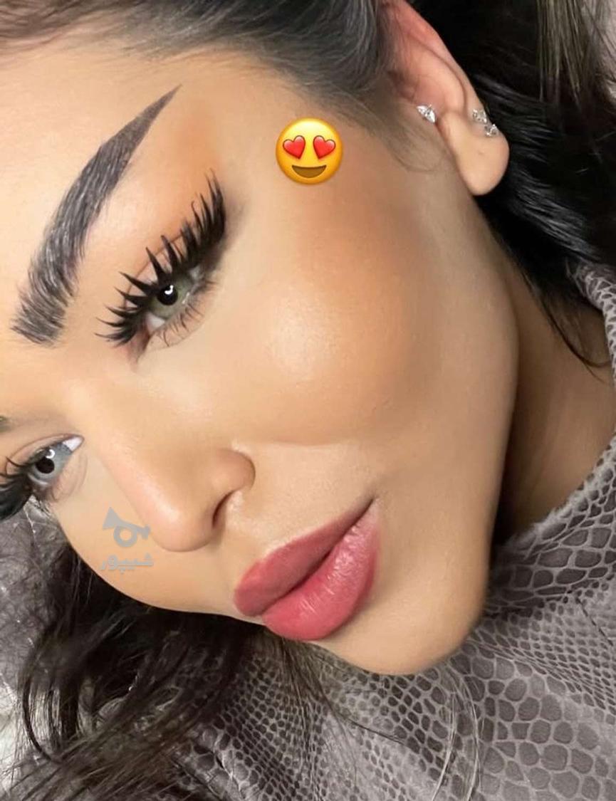 کاشت مژه هیدن 500تا 850 بدون هیچ ریزش و چرخشی