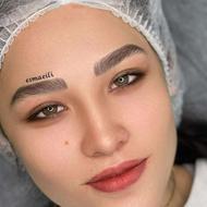 فیبروز ابرو