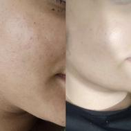 فیشیال و پاکسازی پوست