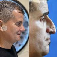 جشنواره‌ *عمل بینی ن *با شرایط اقساط