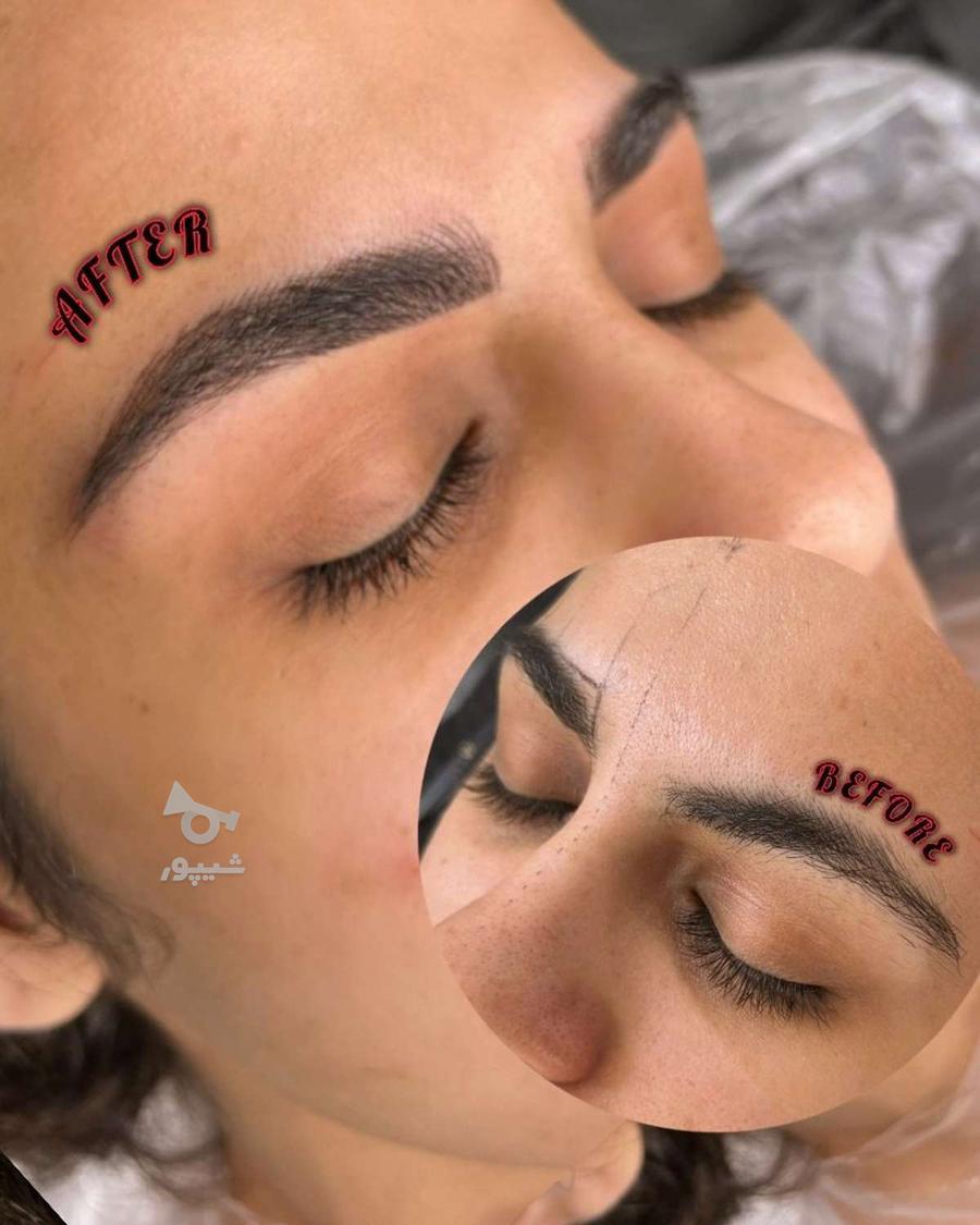 انجام خدمات میکروبلیدینگ و میکروپیگمنتیشن