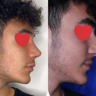 جراحی بینی و زیبایی بلفا و غبغب