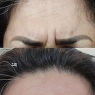 تزریقات زیبایی توسط پزشک