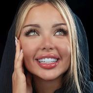 اقساط کامپوزیت ایمپلنت بلیچینگ ارتودنسی لمینیت