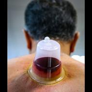 حجامت و تزریقات در منزل