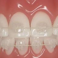 ارتودنسی،ایمپلنت،عصب کشی ،دندانپزشکی