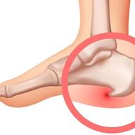 مرکز تخصصی درمان خارپاشنه