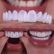 لمینت متحرک ترو اسمایل دوفک+چسب سفید کننده دندان