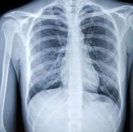 خریدار ضایعات عکس های رادیلوژی