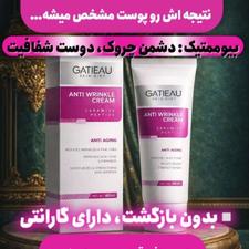 کرم بوتاکس گاتیو