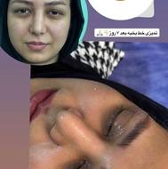جراحی های زیبایی